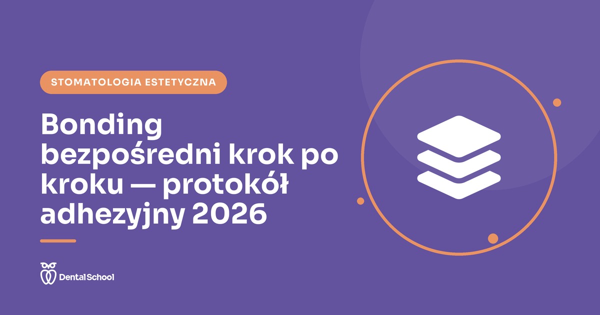 bonding bezpośredni