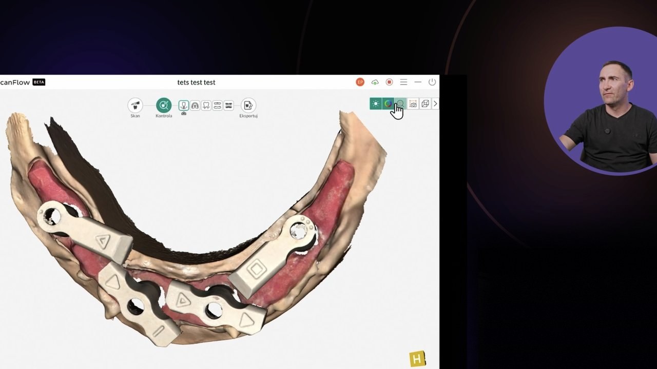 Skan bezzębnego łuku ze scan bodies i flagami do pracy na implantach
